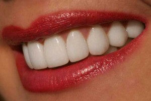 Как быстро отбелить зубы в домашних условиях без вреда для эмали