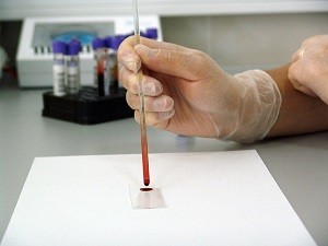 анализы крови необходимые до беременности